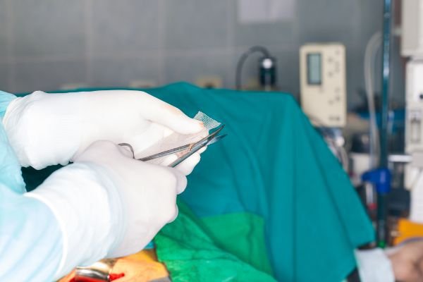 The Dangers of Hernia Mesh