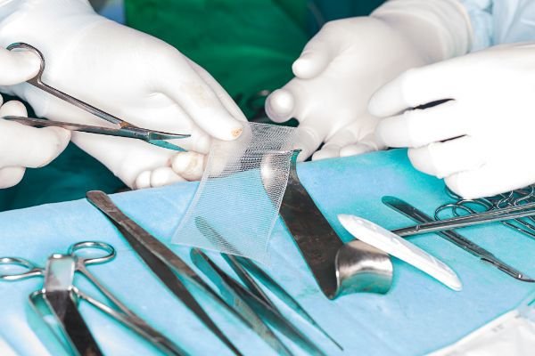 Defective Hernia Mesh Can Result in Second Surgeries