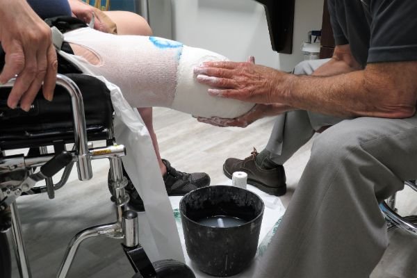 Understanding Amputation Injuries